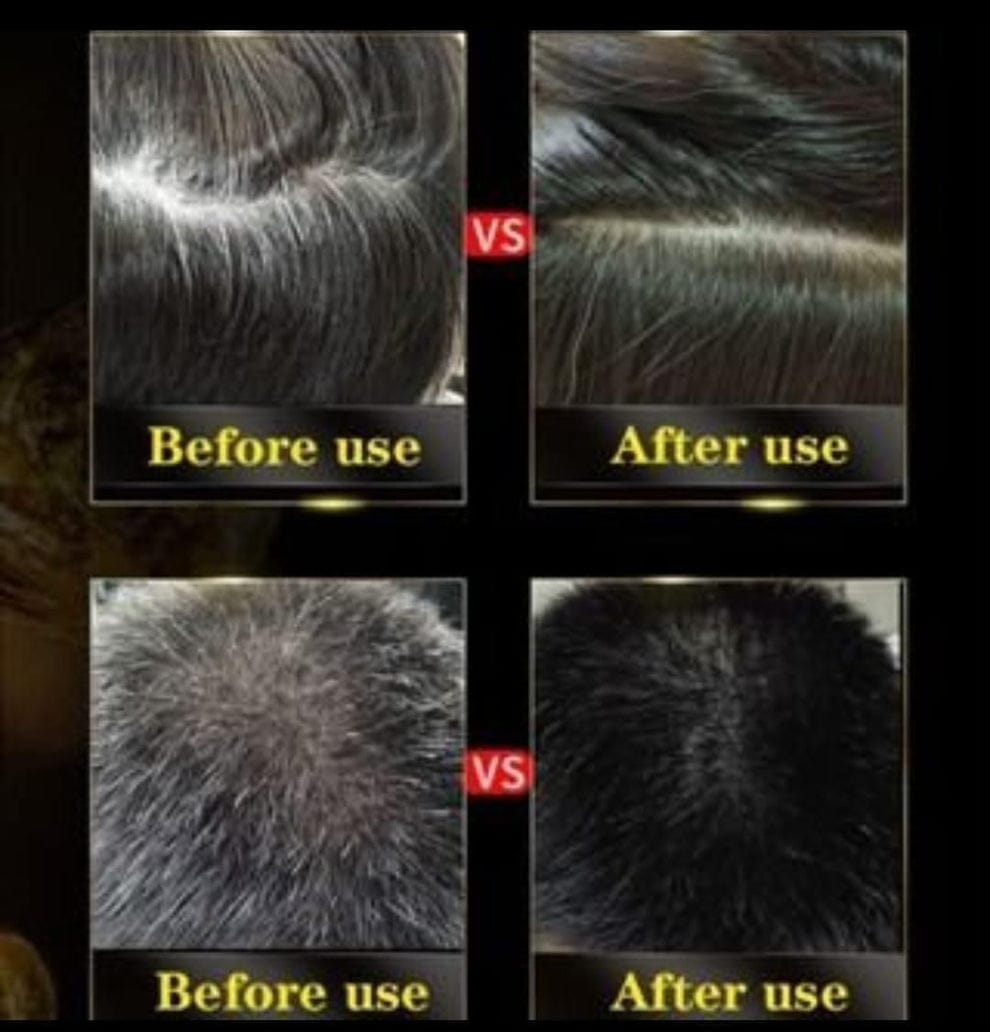 AYURVEDIC 3- IN -1 BLACK HAIR DYE SHAMPOO ( PACK OF 2)⭐⭐⭐⭐⭐(9,500 Ratings)
