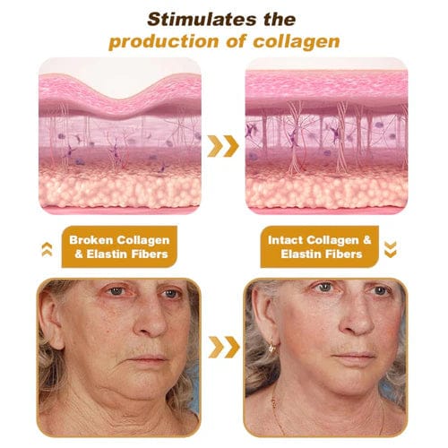 BOTOX™ - BEE VENOM WRINKLE REMOVAL CREAM (🔥🔥BUY 1 GET 1 FREE🔥🔥)