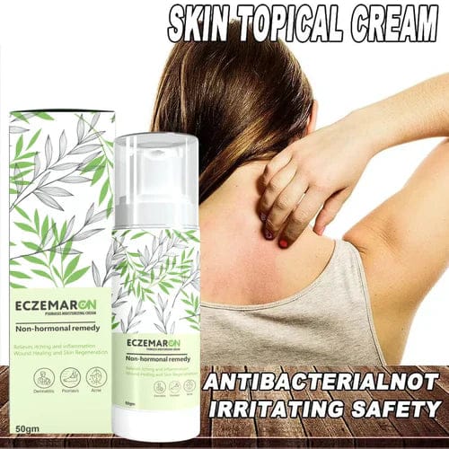 ECZEMARON ANTI - FUNGAL SPRAY - Doctor's  Recommended  👨🏽⚕️(Buy 1 Get 1 Free🔥🔥)(4.9/5.0⭐⭐⭐⭐⭐)