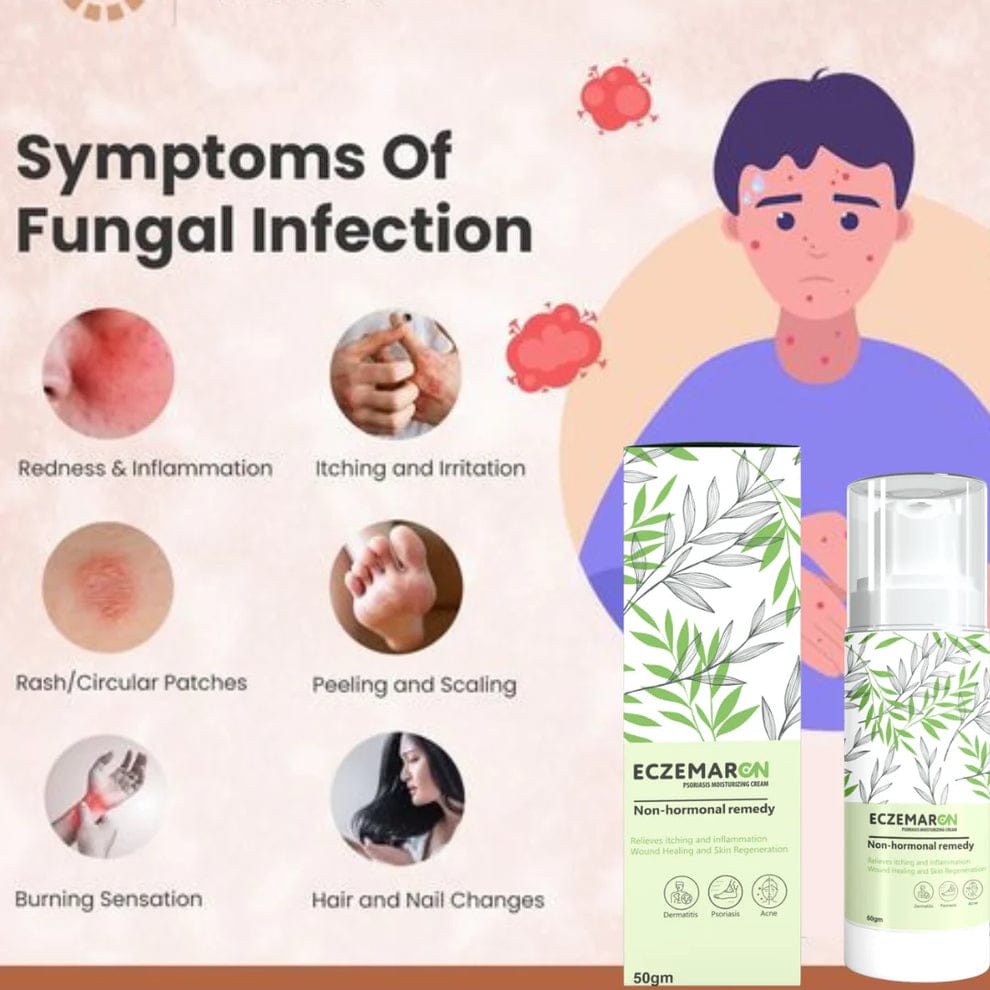 ECZEMARON ANTI - FUNGAL SPRAY - Doctor's  Recommended  👨🏽⚕️(Buy 1 Get 1 Free🔥🔥)(4.9/5.0⭐⭐⭐⭐⭐)