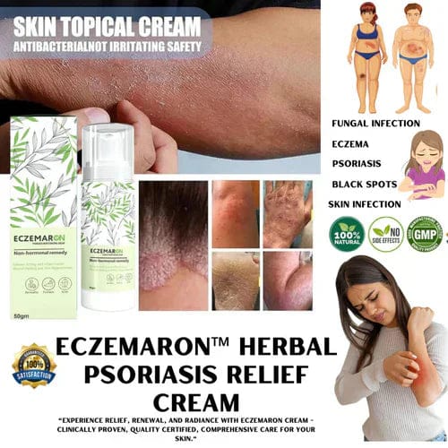 ECZEMARON ANTI - FUNGAL SPRAY - Doctor's  Recommended  👨🏽⚕️(Buy 1 Get 1 Free🔥🔥)(4.9/5.0⭐⭐⭐⭐⭐)