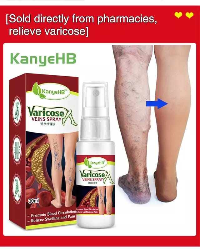 Varicose Veins Treatment Spray (🔥🔥buy 1 get 1 free🔥🔥)