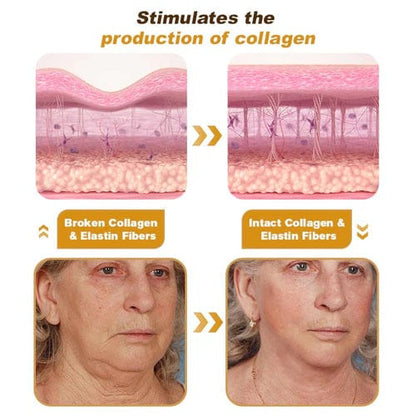 BOTOX™ - BEE VENOM WRINKLE REMOVAL CREAM (🔥🔥BUY 1 GET 1 FREE🔥🔥)