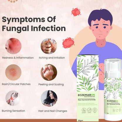 ECZEMARON ANTI - FUNGAL SPRAY - Doctor's  Recommended  👨🏽‍⚕️(Buy 1 Get 1 Free🔥🔥)(4.9/5.0⭐⭐⭐⭐⭐)
